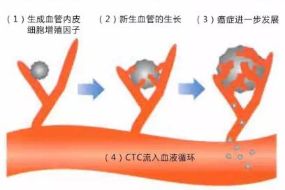 CTC檢查是測定血液中流動(dòng)癌細(xì)胞的一種檢查