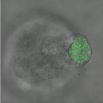 華中科大研發(fā)出測量三維生物力的新技術(shù)，有望用于癌癥早期診斷