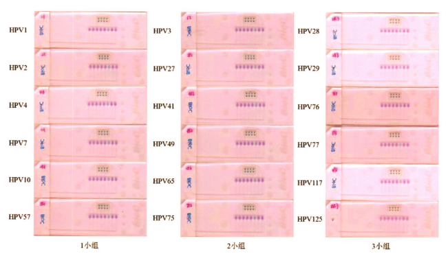 圖2皮膚低危型別中3小組組內(nèi)特異性檢測(cè)